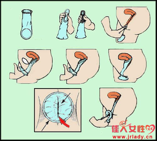 避孕套使用方法演示女